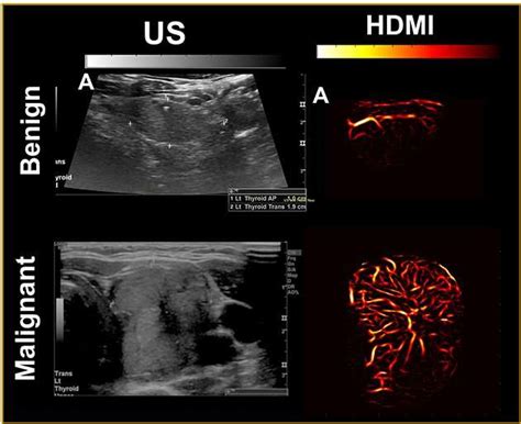 advanced ultrasound systems|Advanced Ultrasound Technologies for Diagnosis and .